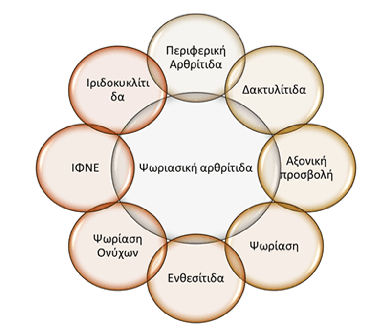 psoriasiki arthritisa simptomata 1 -